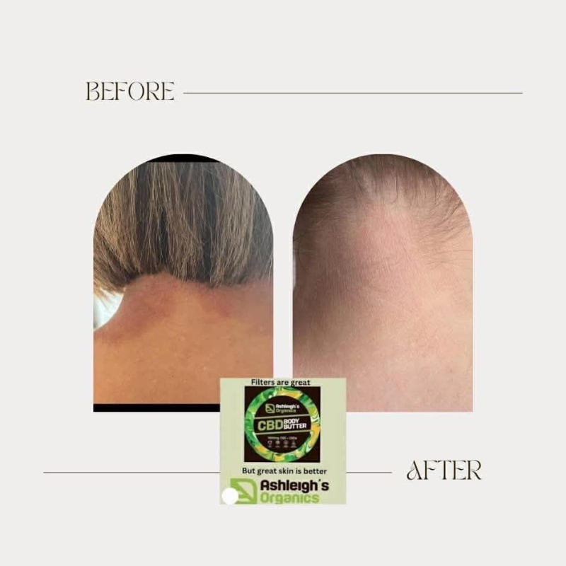 Ashleigh's Organics CBD 🌿Body Butter